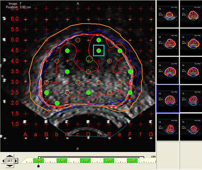 Variseed Screenshot